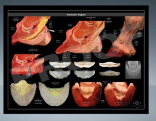 POSTER - NAVICULAR SYNDROME 61x45 CM
